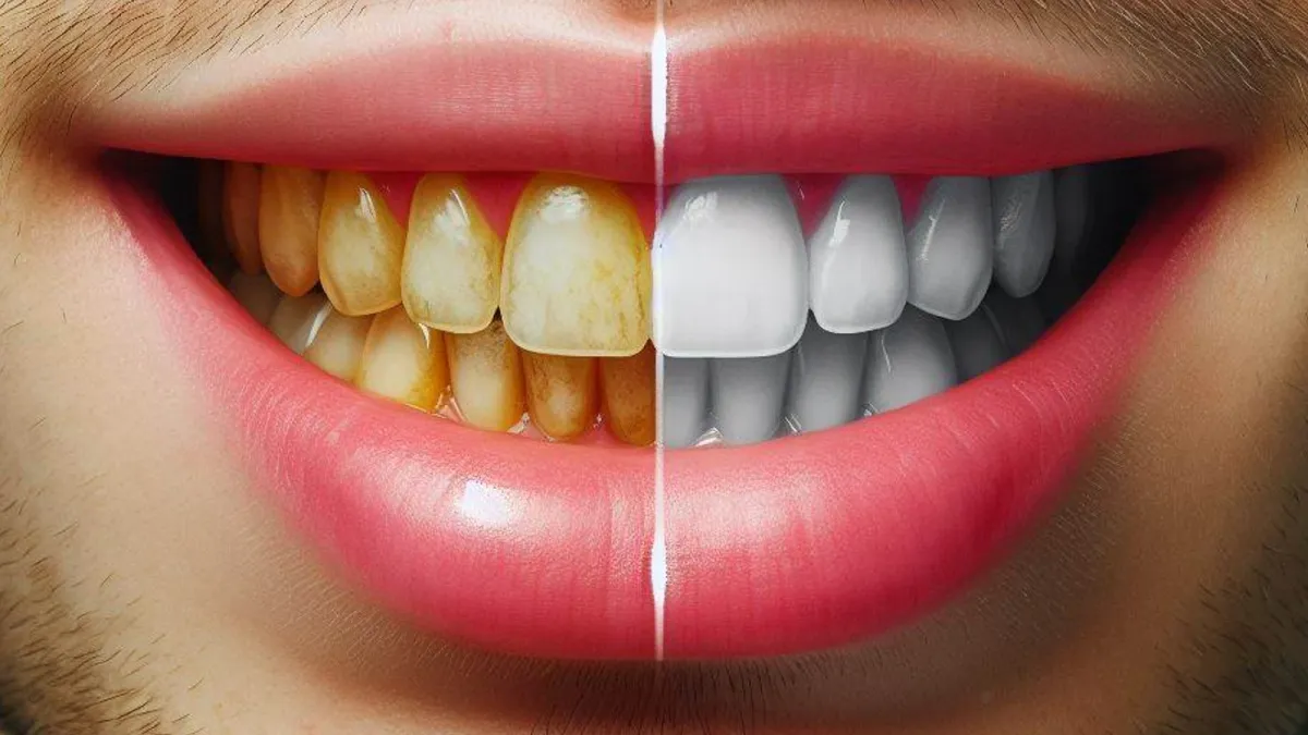 UK Google Ads policy loosens restrictions on Teeth Whitening products